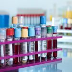 laboratory specimen transport
